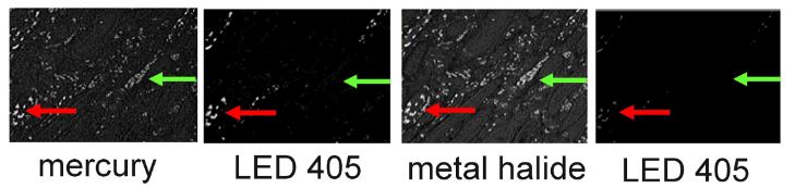 High levels of autofluorescence and fast photobleaching of specific fluorescence when illuminating Qdots with Metal Halide