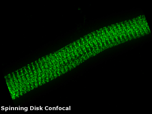 Image acquired with Spinning Disk Confocal Imager