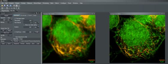 Image overlay with DNA staining in green and Microtubule staining in orange