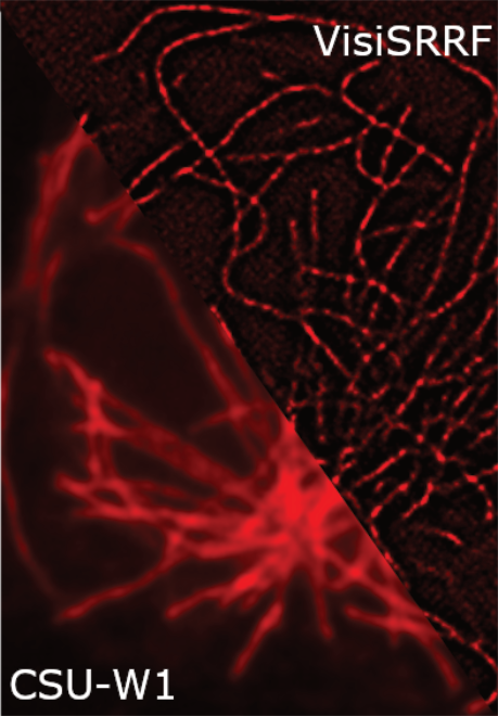 Labeled microtubules processed by VisiSRRF